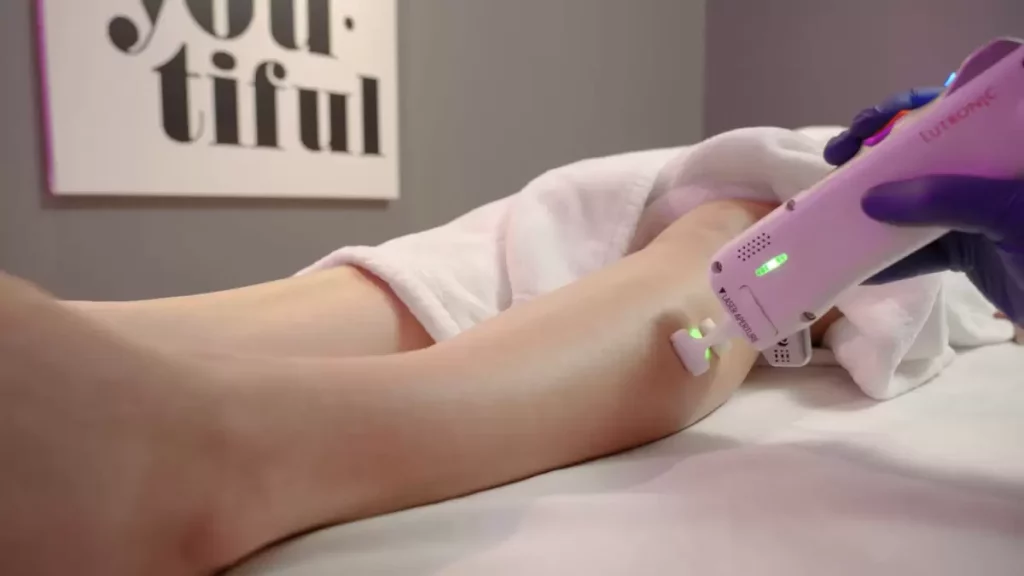Laser Hair Removal Treatments | H-Town Aesthetics | Katy, TX