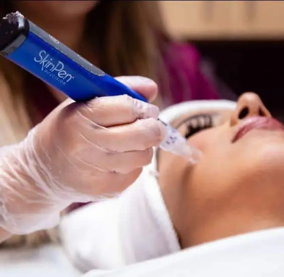 SkinPen Microneedling Treatments | H-Town Aesthetics | Katy, TX