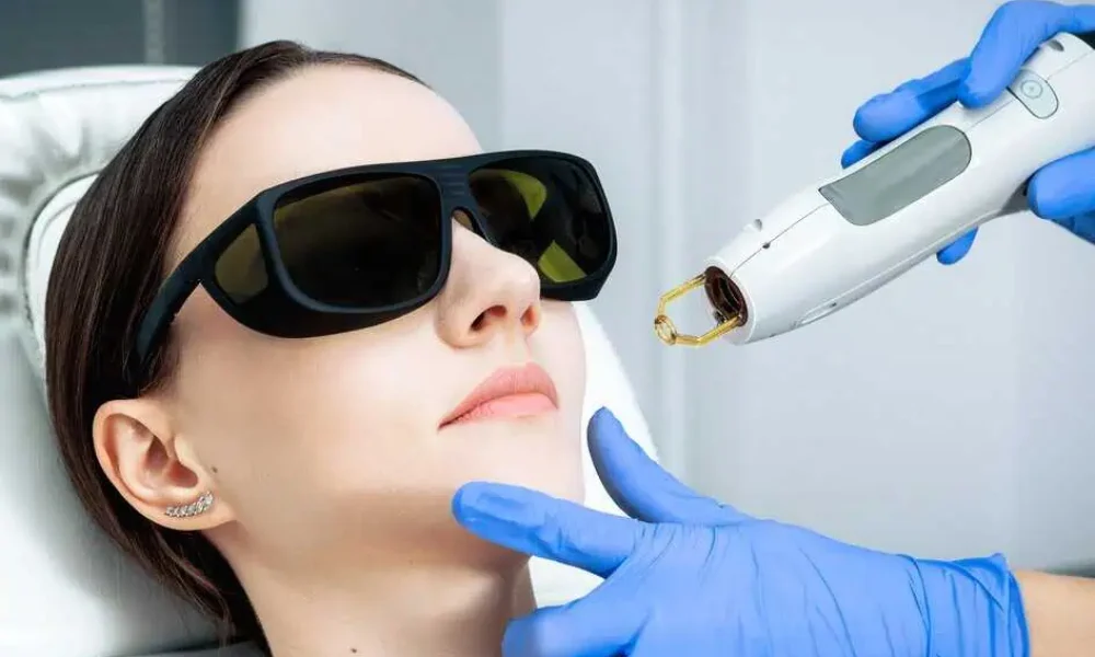 Capillaries, elangiectasia Treatment In Texas by HTown Aesthetics, PLLC